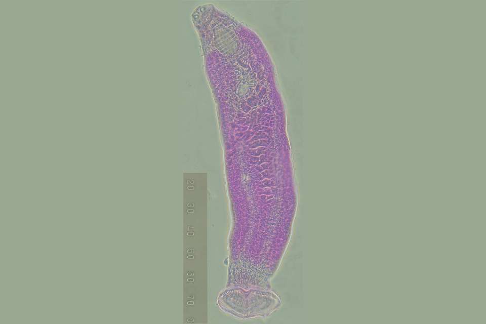 Parasitic worm_CQU news.jpg